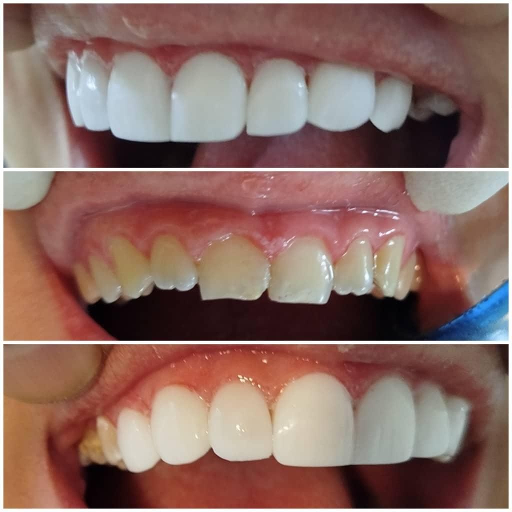 دندانپزشکی لبخند|خدمات آرایشگری و زیبایی|پاکدشت, پاکدشت (مامازند)|دیوار