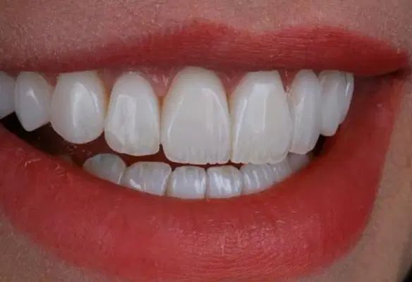 تکنسین لابراتوار دندانسازی|استخدام درمانی، زیبایی، بهداشتی|مشهد, سجاد شهر|دیوار