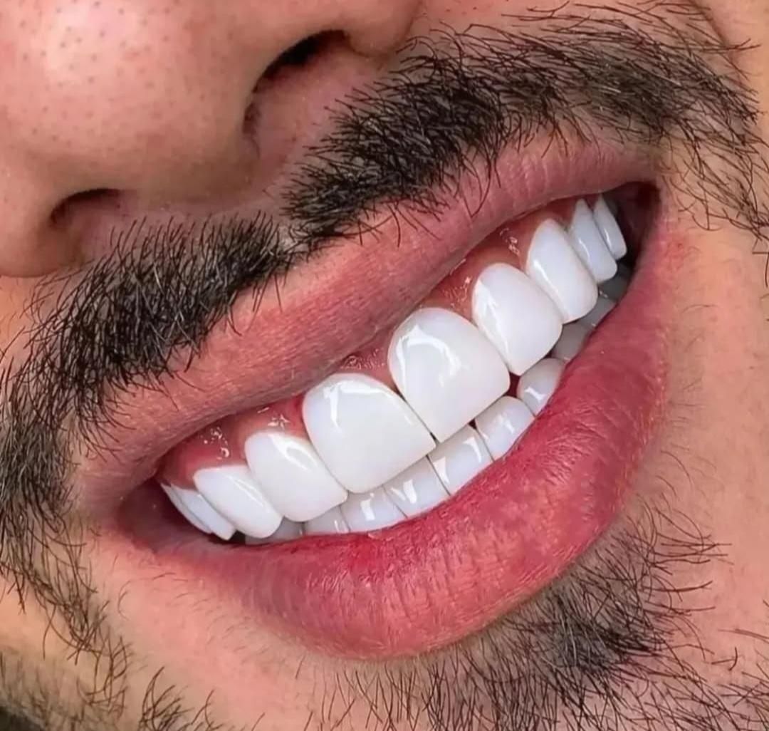 دندانپزشکی با خدمات کامل و شرایط اقساط ویژه|خدمات آرایشگری و زیبایی|اصفهان, لاله|دیوار