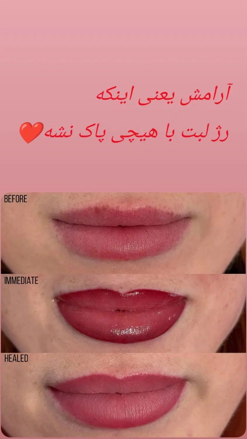 مرکزفیبروز وشیدینگ با موادبدون سرب وگیاهی آمریکایی|خدمات آرایشگری و زیبایی|کرمانشاه, |دیوار