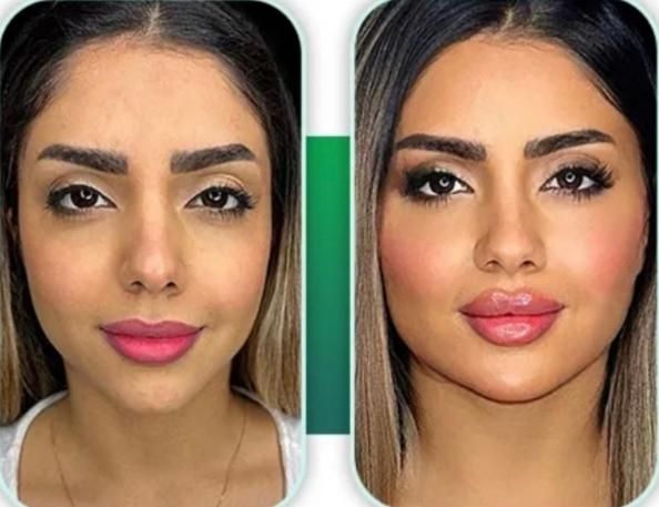 فیلر شقیقه فیلر زیر چشم نخ لیفت ابرو و چشم گربه ای|خدمات آرایشگری و زیبایی|قم, زنبیل آباد|دیوار