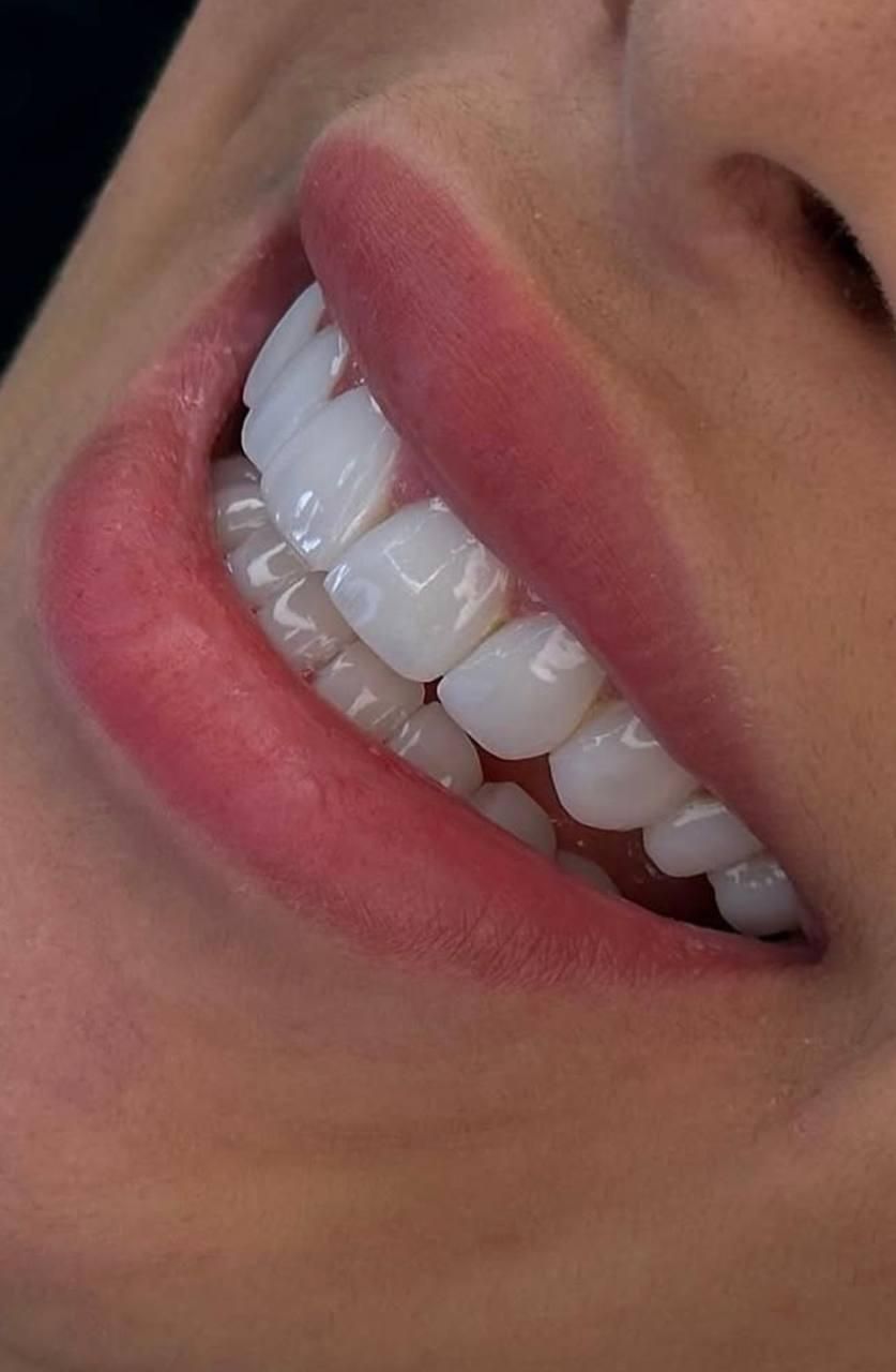 دندانپزشکی/کامپوزیت/لمینیت/ایمپلنت|خدمات آرایشگری و زیبایی|تهران, قبا|دیوار