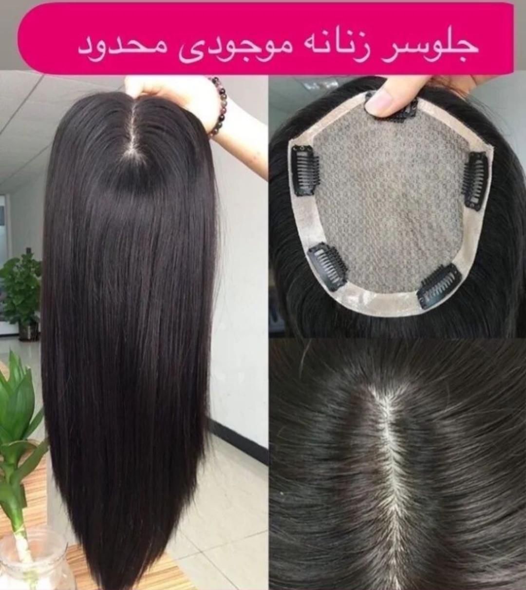 فروش و ترمیم پروتز مو طبیعی|خدمات آرایشگری و زیبایی|رشت, سعدی (تختی)|دیوار