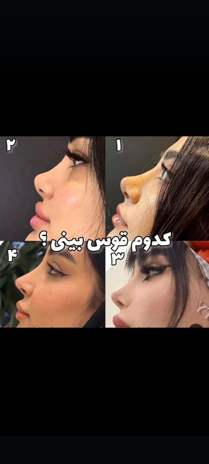 تزریق چربی، بلفاروپلاستی پلک، بینی اتوپلاستی گوش|خدمات آرایشگری و زیبایی|تهران, ستارخان|دیوار