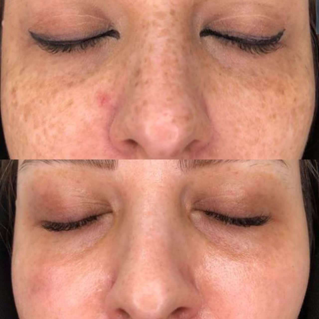 کلینیک پوست رفع لک باتکنیک فلت اولین بار در یزد|خدمات آرایشگری و زیبایی|یزد, |دیوار