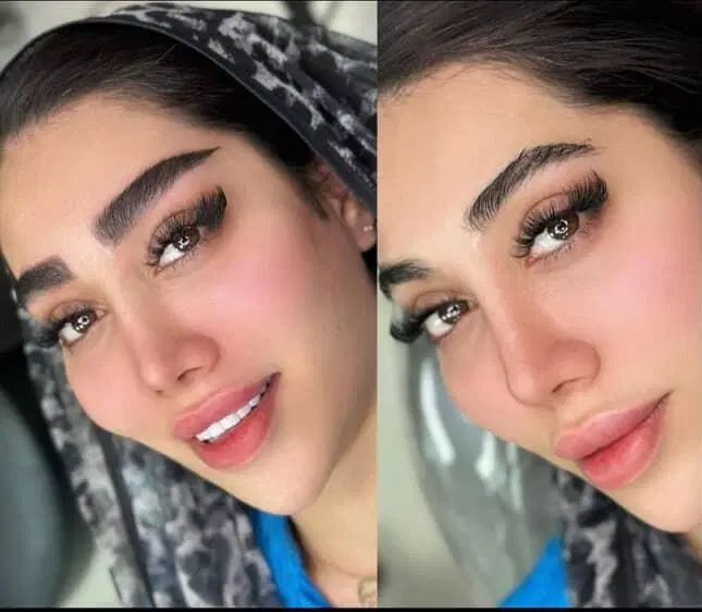 تغییر چهره با میکروبلیدینگ یک جلسة|خدمات آرایشگری و زیبایی|مشهد, بهار|دیوار