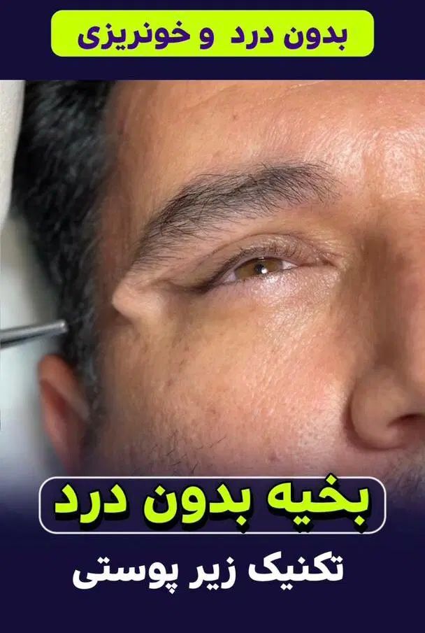 چشمانتان را جوان تر و درخشان تر کنید|خدمات آرایشگری و زیبایی|تهران, جردن|دیوار
