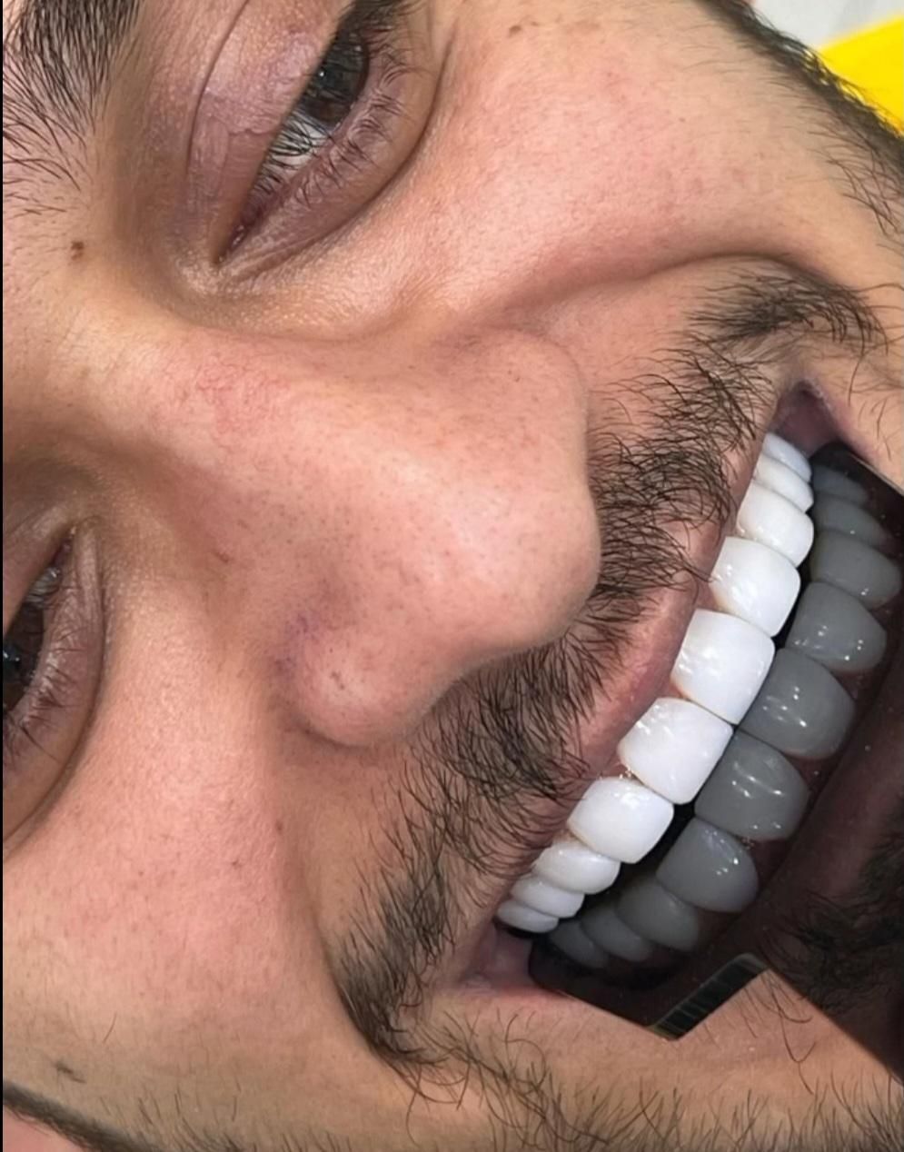 جشنواره خدمات زیبایی دندان با افر 60٪ از دست ندید|خدمات آرایشگری و زیبایی|بابل, |دیوار