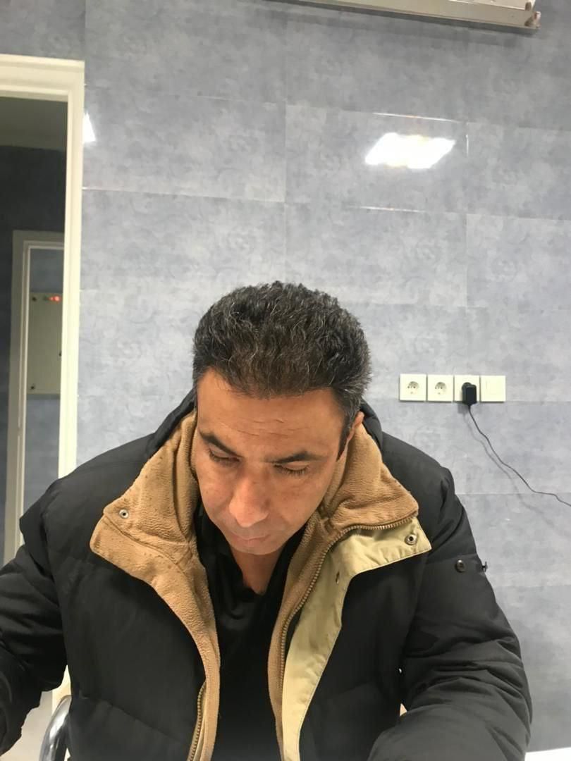 کاشت مو و ابرو بدون پیش پرداخت با چک و حتی سفته|خدمات آرایشگری و زیبایی|مشهد, وکیل‌آباد|دیوار