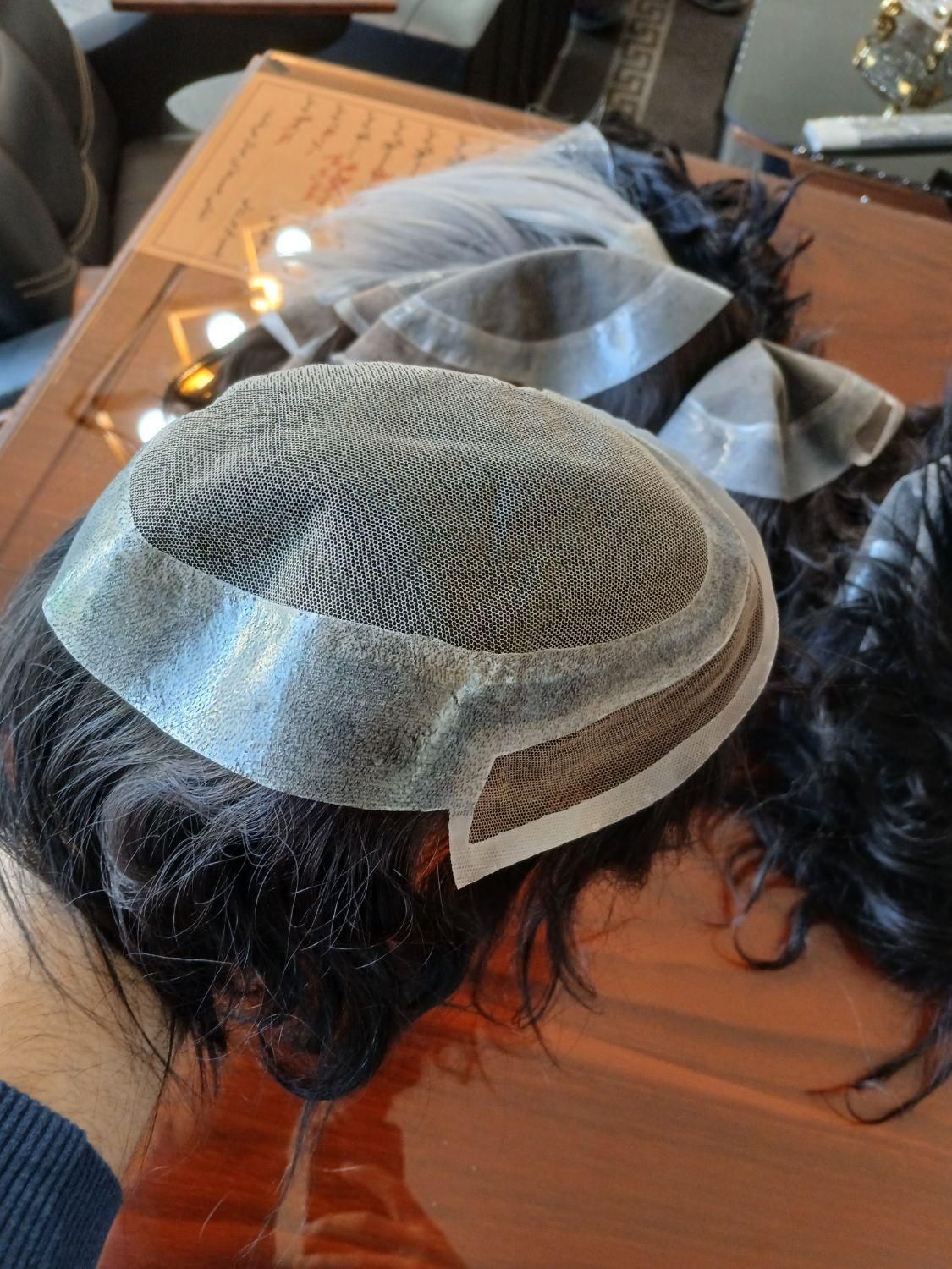 پروتز موی مردانه|آرایشی، بهداشتی، درمانی|تبریز, |دیوار