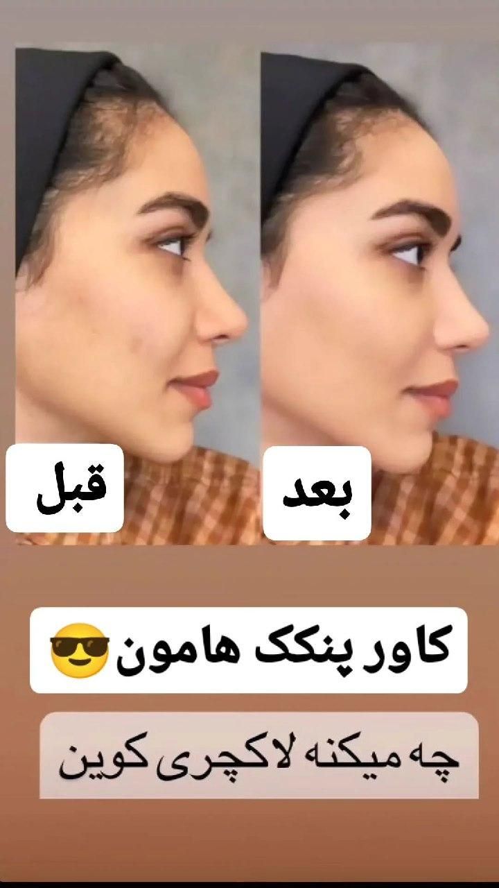 پنکک لاکچری کوین|آرایشی، بهداشتی، درمانی|پره‌سر, |دیوار