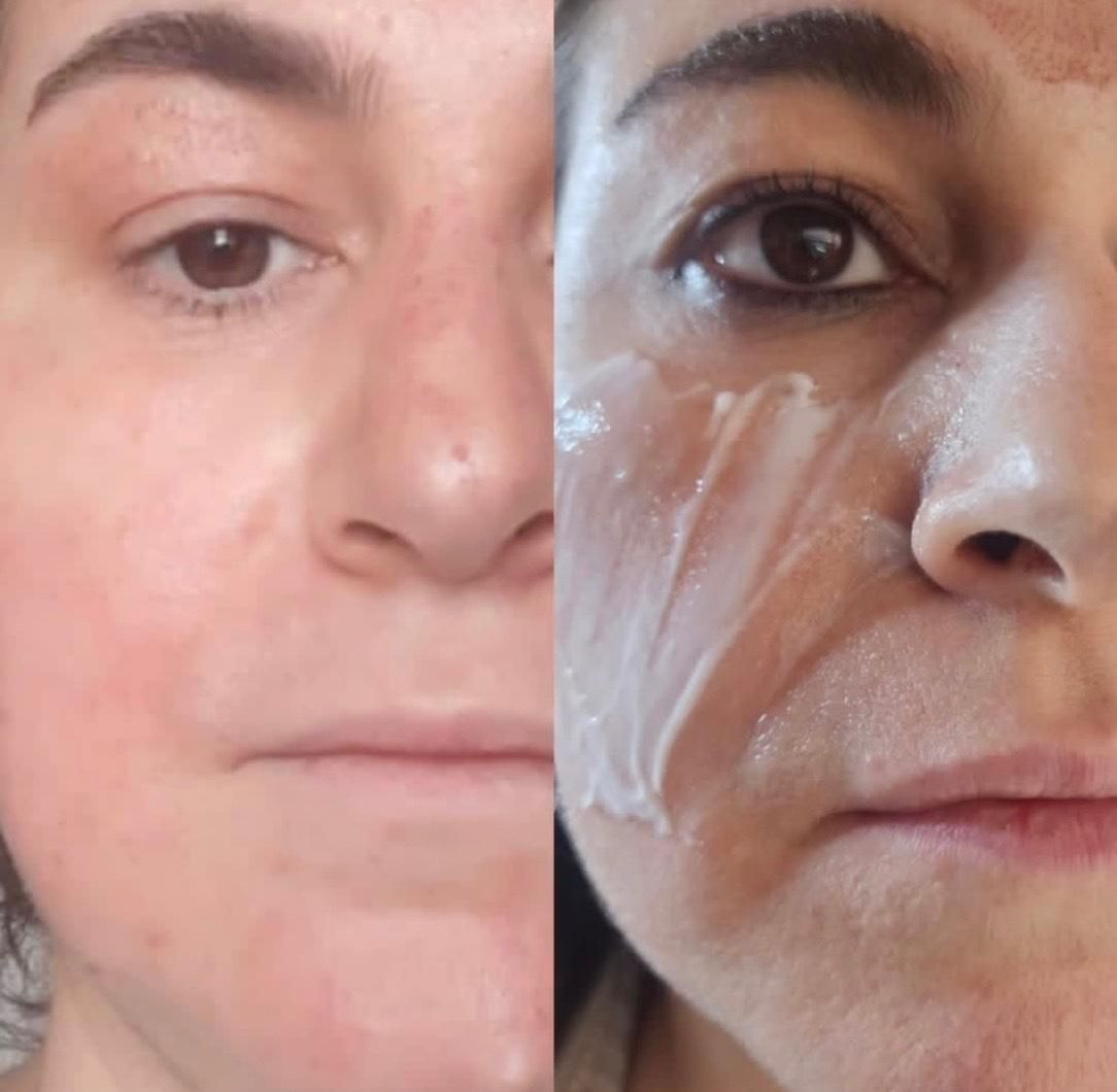 جوانسازی صورت بدون جراحی با تخفیف ویژه|خدمات آرایشگری و زیبایی|تهران, اقدسیه|دیوار