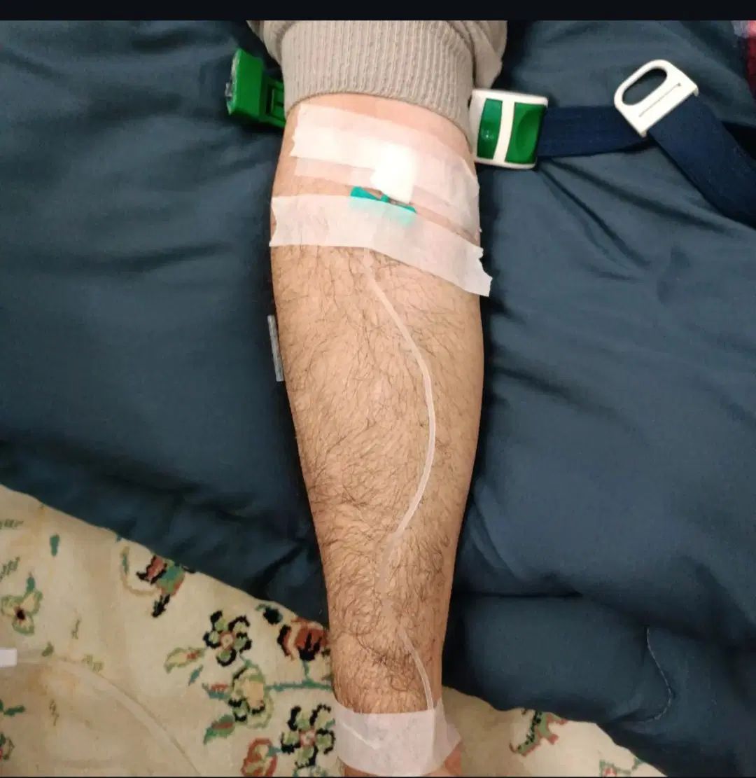 تزریقات در منزل،وصل سرم در منزل همرا سرم و آمپول|خدمات آرایشگری و زیبایی|فردیس, منظریه|دیوار