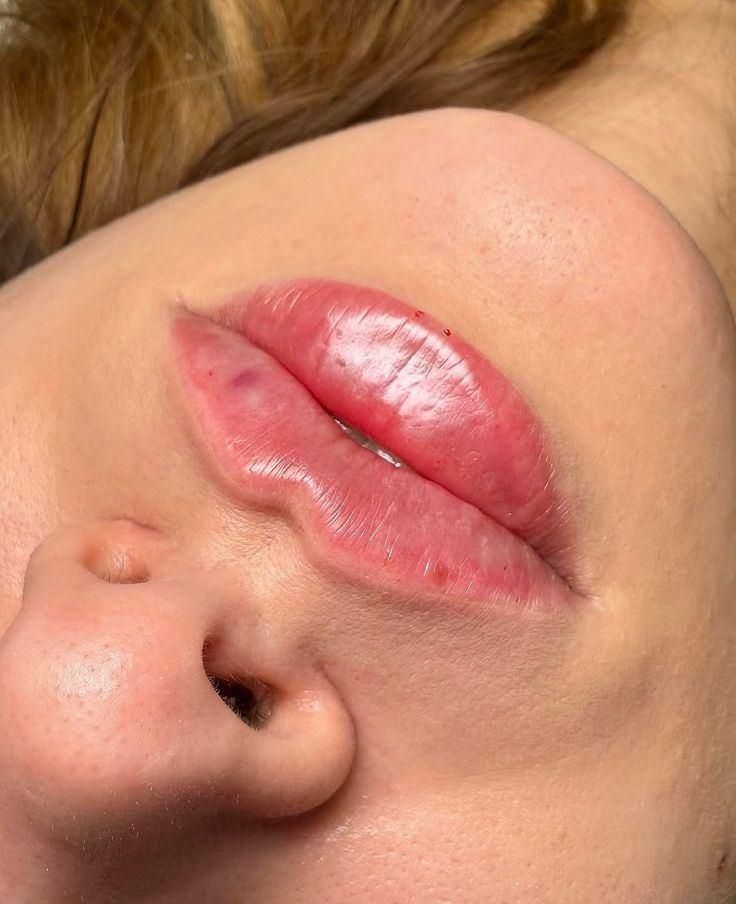 مطب پوست مو تزریق بوتاکس فیلر مزوتراپی هایفو|خدمات آرایشگری و زیبایی|محمدشهر, |دیوار