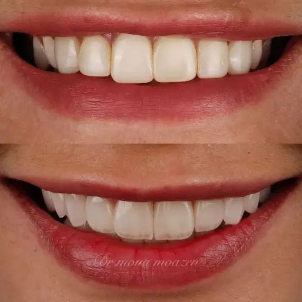 کاراموز دندانسازی|استخدام درمانی، زیبایی، بهداشتی|کرمانشاه, |دیوار