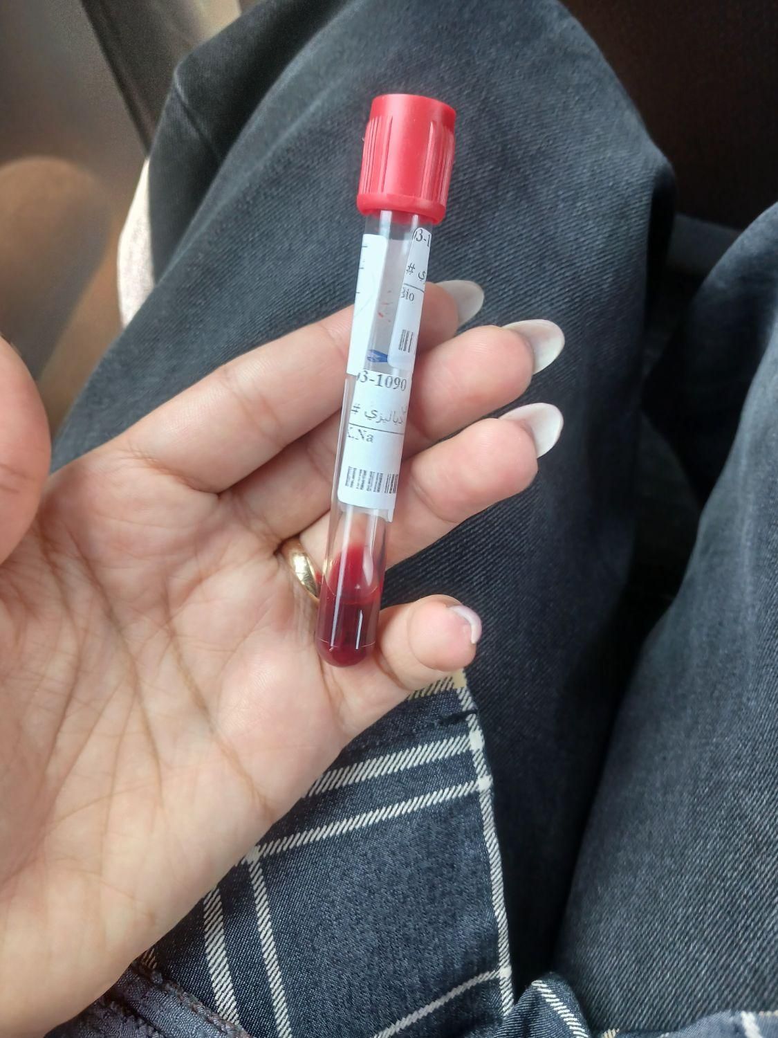 تزریقات و سرم تراپی در منزل|خدمات آرایشگری و زیبایی|پرند, فاز ۰|دیوار