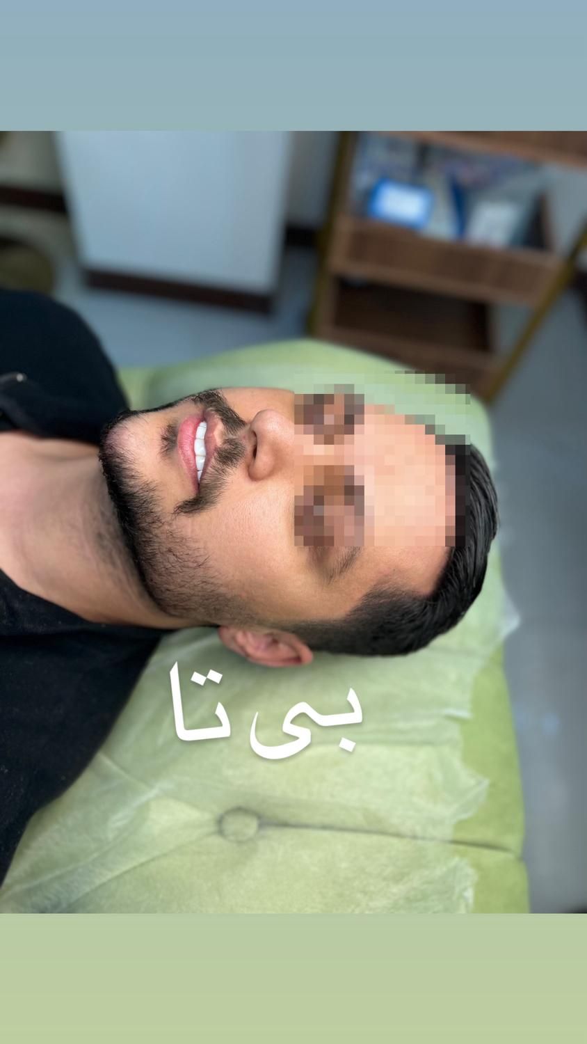 کلیه خدمات درکلینیک ازسیسی480|خدمات آرایشگری و زیبایی|نسیمشهر, |دیوار