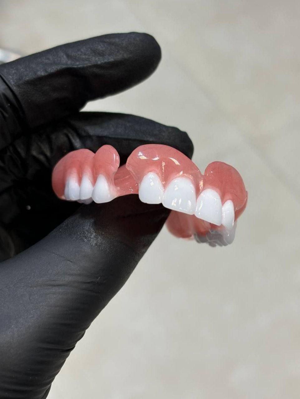 دندانپزشک و دندانساز تجربی (ساخت پروتز مصنوعی)|خدمات آرایشگری و زیبایی|ابهر, |دیوار