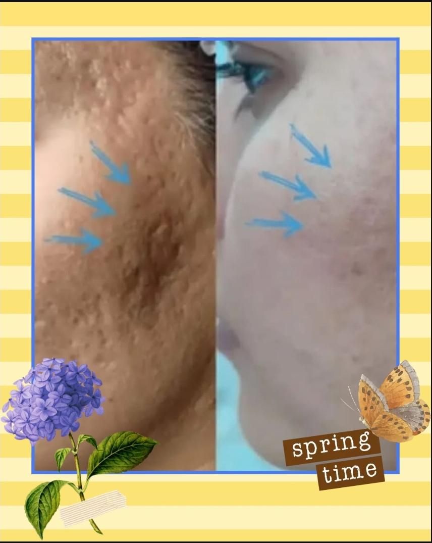 خاویارتراپی صورت و بدن|خدمات آرایشگری و زیبایی|مشهد, طلاب|دیوار