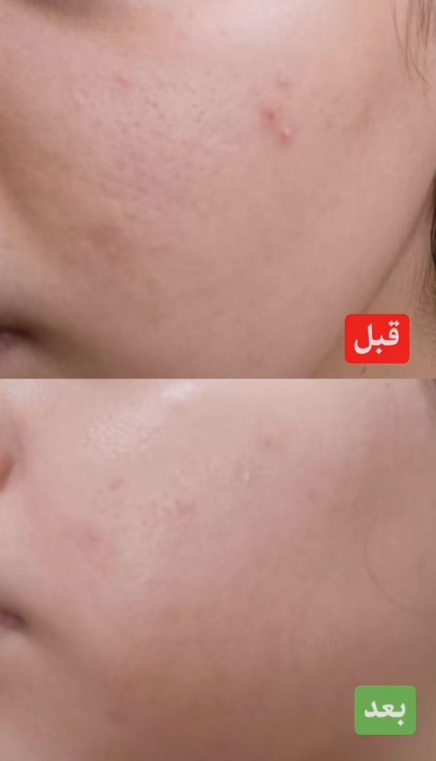 آموزش و خدمات فیشال فوق تخصصی صورت و بدن در کلینیک|خدمات آرایشگری و زیبایی|قم, سالاریه|دیوار