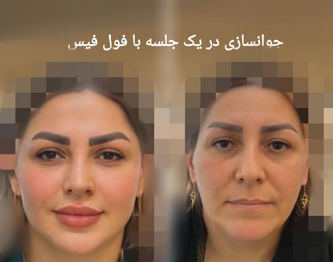 جشنواره تخفیفات کلینیک پوست همراه با هدیه|خدمات آرایشگری و زیبایی|مشهد, کوه سنگی|دیوار