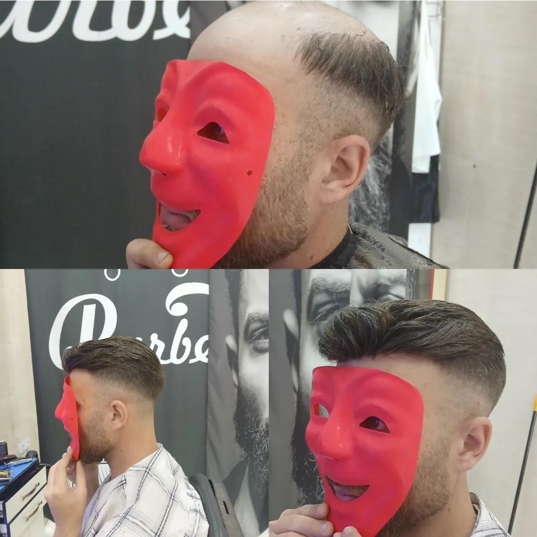 پروتز مو|خدمات آرایشگری و زیبایی|تهران, شهرک ولیعصر جنوبی|دیوار