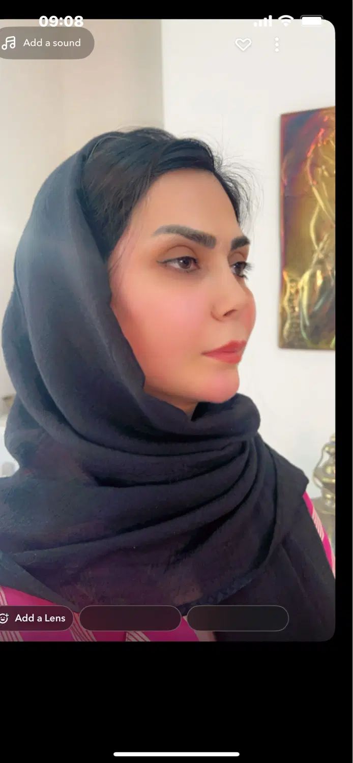تزریق چربی باجدیدترین متد، لیفت نخ ،لیپو غبغب|خدمات آرایشگری و زیبایی|تهران, سعادت‌آباد|دیوار