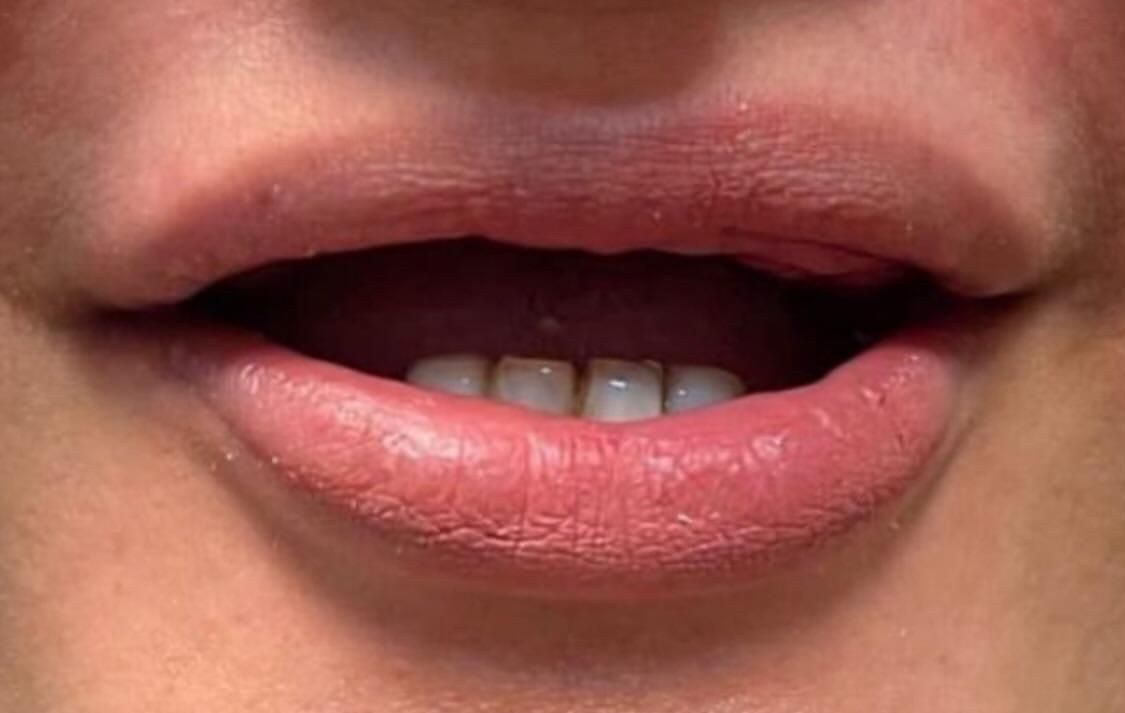 دندان مصنوعی (پروتز)|خدمات آرایشگری و زیبایی|گالیکش, |دیوار