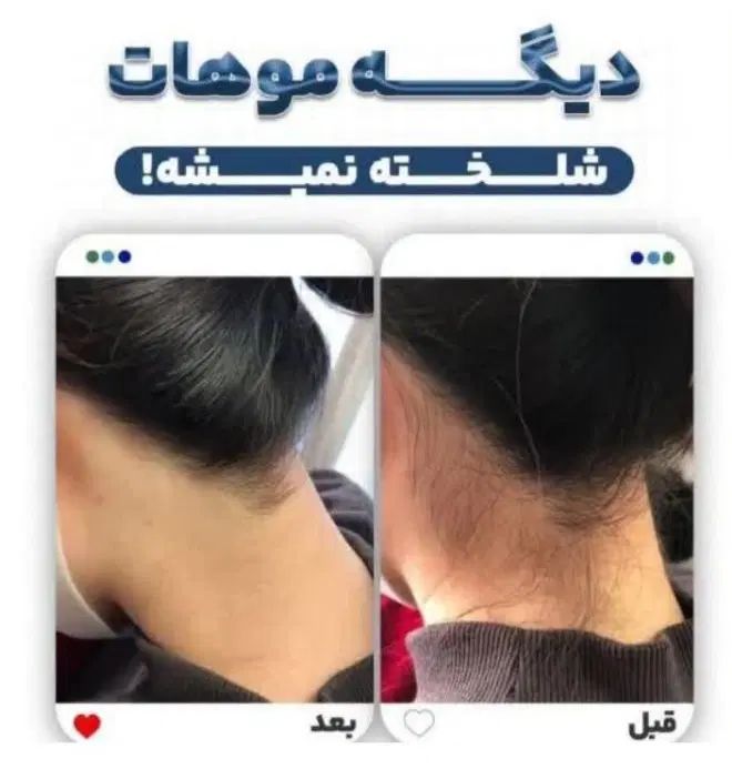 آموزش لیزر موج کندلا مرکز لیزر آقایان لیزر بانوان|خدمات آموزشی|اصفهان, شمس آباد|دیوار