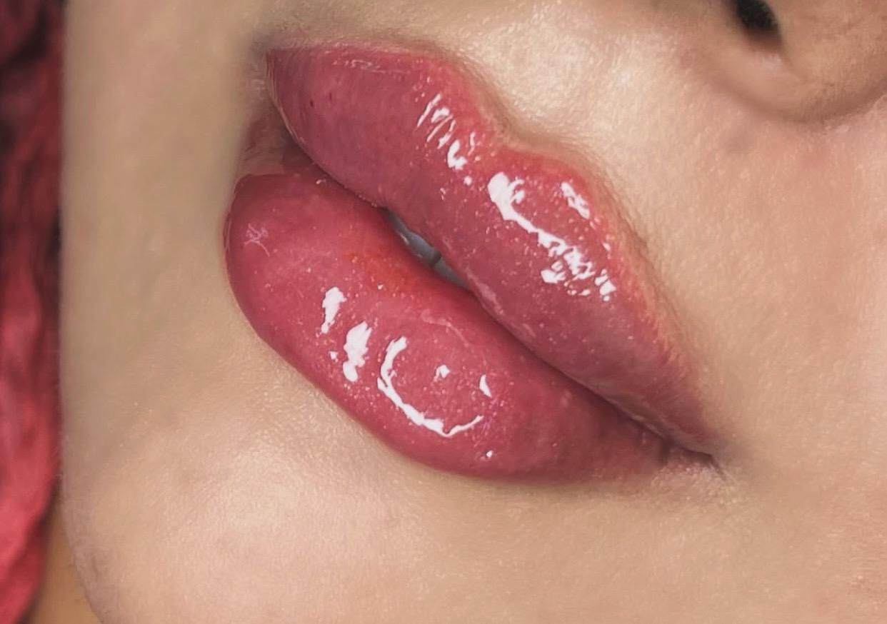 تزریق ژل و بوتاکس و فیلر طبیعی|خدمات آرایشگری و زیبایی|صدرا-فارس, |دیوار