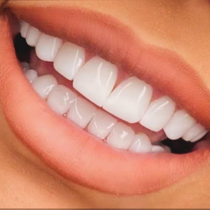 تخفیف فصلی کامپوزیت (1/500ت).عصب کشی در ایرانمهر|خدمات آرایشگری و زیبایی|یاسوج, |دیوار