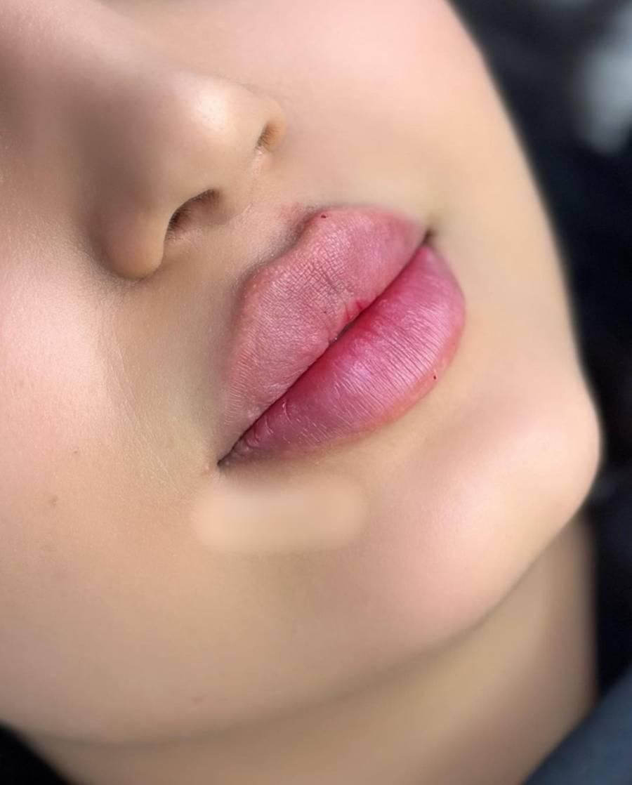 ژل بوتاکس،لابیاپلاستی،حذف لک،ریموو تتو،لاغری|خدمات آرایشگری و زیبایی|ارومیه, |دیوار