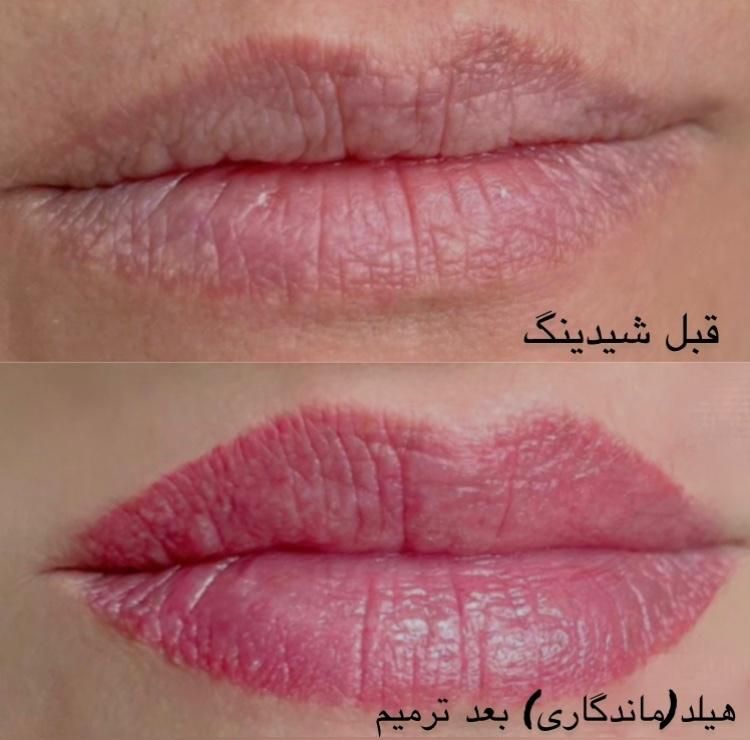 خدمات آرایش دائم فقط هزینه مواد|خدمات آرایشگری و زیبایی|لاهیجان, امیرشهید|دیوار