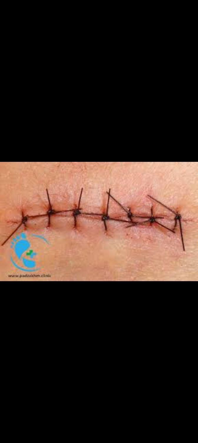 خدمات پرستاری منزل،تزریقات،سرم تراپی پانسمان حجامت|خدمات آرایشگری و زیبایی|چناران, |دیوار