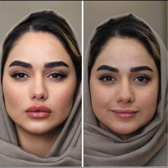 مدل رایگان دستگاه آراف جوان ساز ویا آبرسانی در مطب|خدمات آرایشگری و زیبایی|اصفهان, همدانیان|دیوار