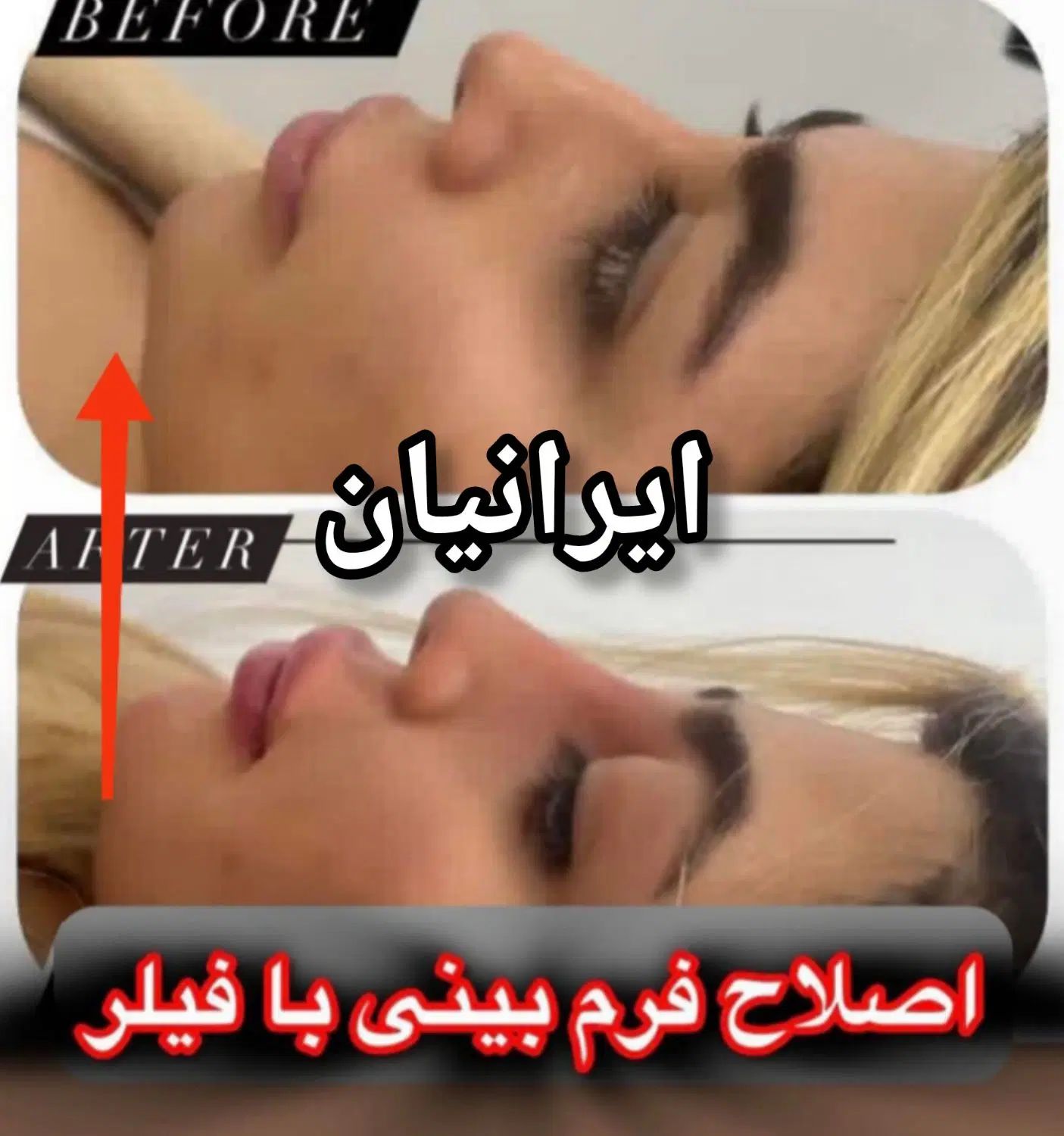 خال،فیلر،بوتاکس،انزیم،تخفیف ۵۰درصدی جشنواره ای|خدمات آرایشگری و زیبایی|کرمانشاه, |دیوار