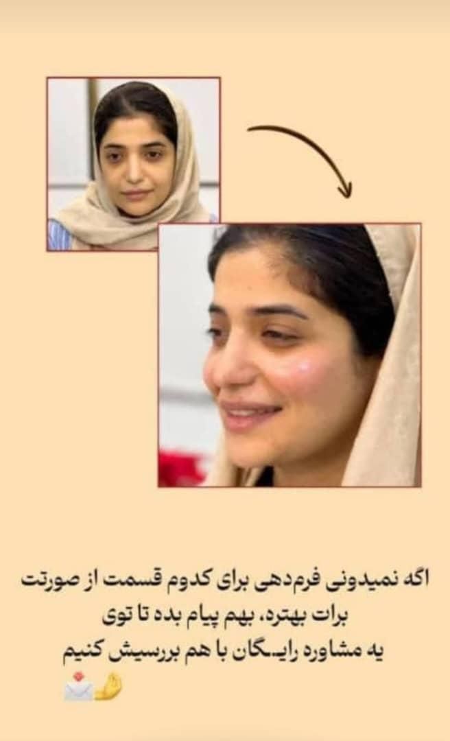 انجام کلیه خدمات تزریق بوتاکس ژل مزو وآنزیم|خدمات آرایشگری و زیبایی|بندر ماهشهر, |دیوار