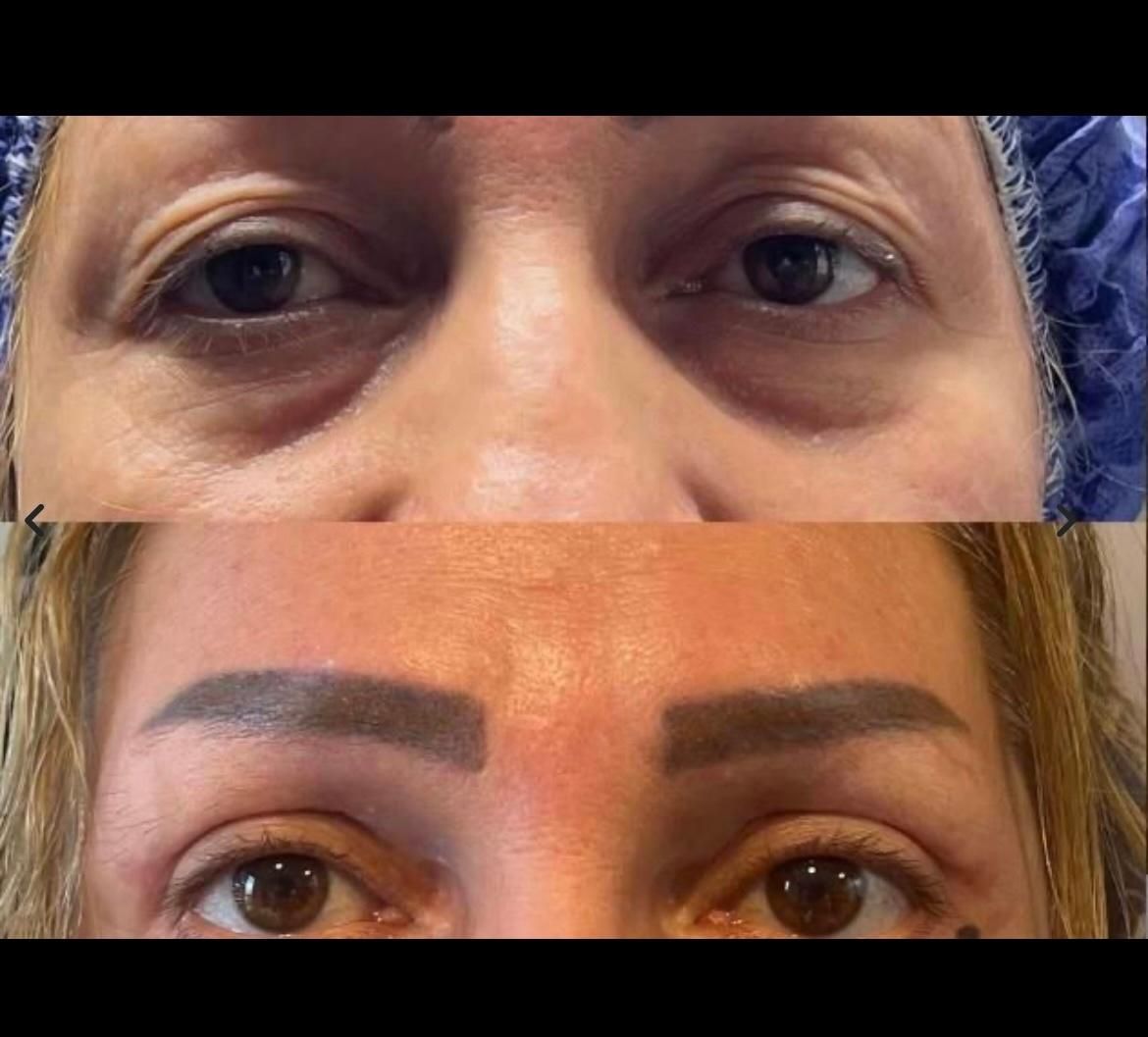 لیپوساکشن شکم و پهلو،ترنسفر به باسن،هایفودابلوگولد|خدمات آرایشگری و زیبایی|اصفهان, دشتستان|دیوار