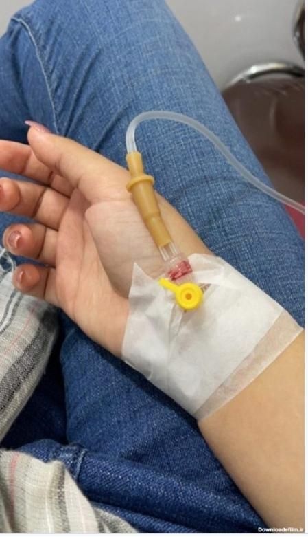 تزریقات سرم سوند پانسمان زخم بستر پای دیابتی|خدمات آرایشگری و زیبایی|تبریز, |دیوار