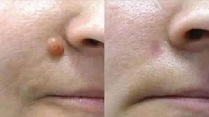 سوراخ کردن گوش و بینی و خالبرداری وچال گونه|خدمات آرایشگری و زیبایی|زاهدان, |دیوار