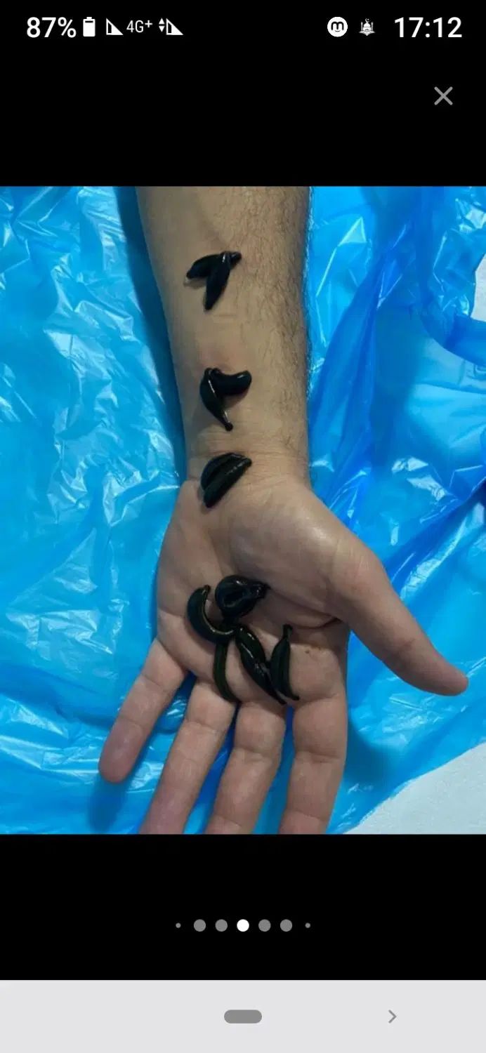 ماساژ ورگ گیری ،حجامت، دیسک ، ،زالو|خدمات آرایشگری و زیبایی|نیشابور, شهرک جانبازان|دیوار