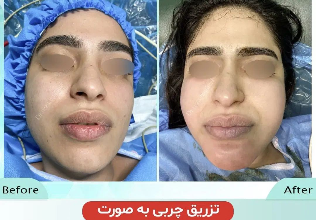 ابدو/ لیفت /پروتز و ساکشن کل بدن|خدمات آرایشگری و زیبایی|مشهد, کوه سنگی|دیوار