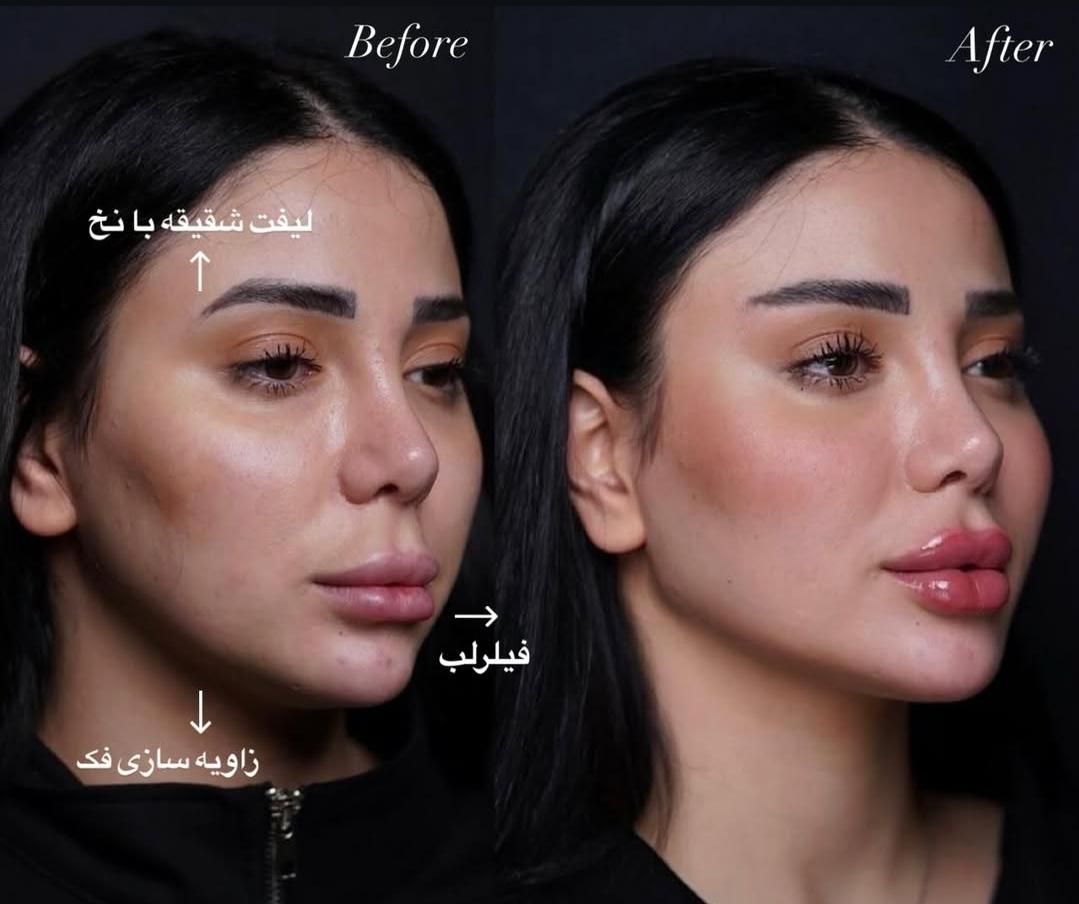 زیبایی حق شماست به خودتون هدیه بدید|خدمات آرایشگری و زیبایی|رشت, گلسار|دیوار