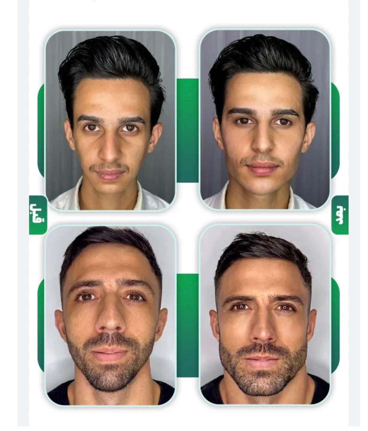 مدل تعداد محدود جهت تزریق لب روسی و کانتورینگ صورت|خدمات آرایشگری و زیبایی|تهران, زعفرانیه|دیوار