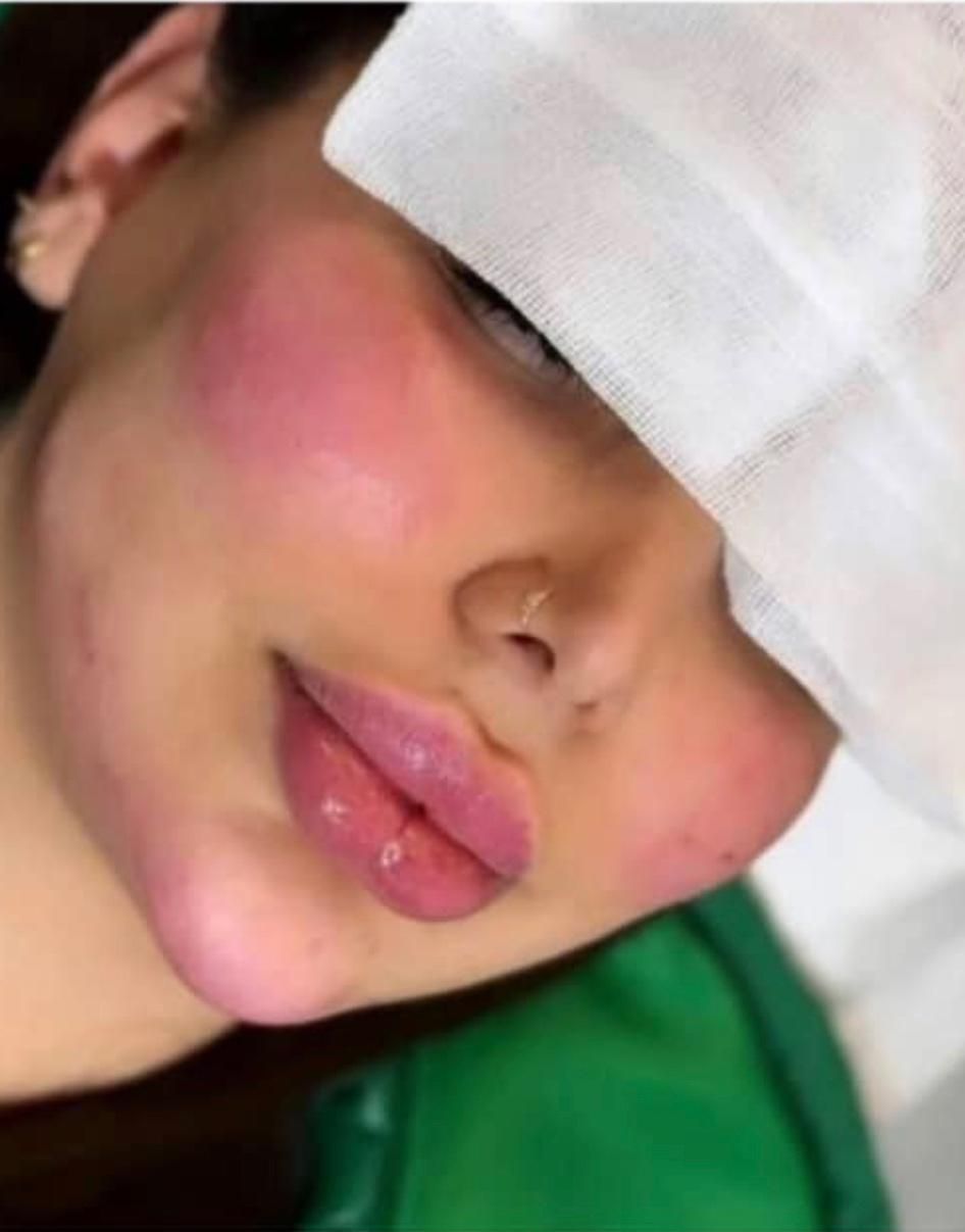 ** جشنواره تخفیفات بهاره تا خرداد *دکتر ابدال*|خدمات آرایشگری و زیبایی|اصفهان, ملک‌شهر|دیوار