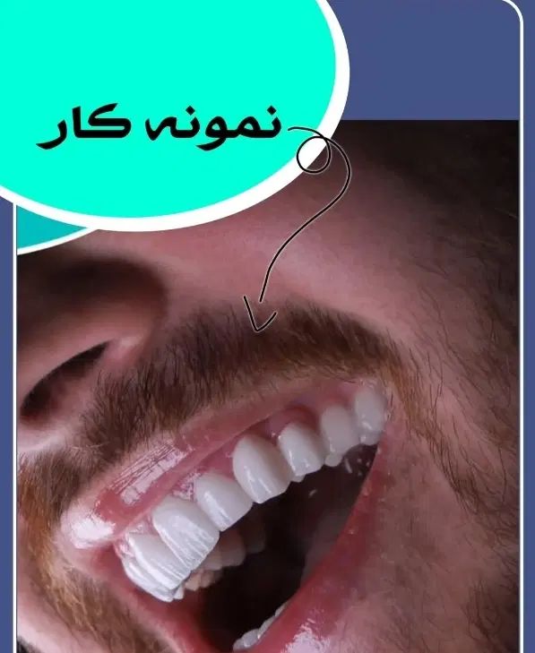 لبخند شما افتخار ماست|خدمات آرایشگری و زیبایی|اصفهان, باتون|دیوار