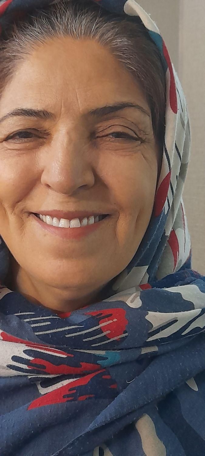 دندان مصنوعی دست دندان|خدمات آرایشگری و زیبایی|تهران, دهکده المپیک|دیوار