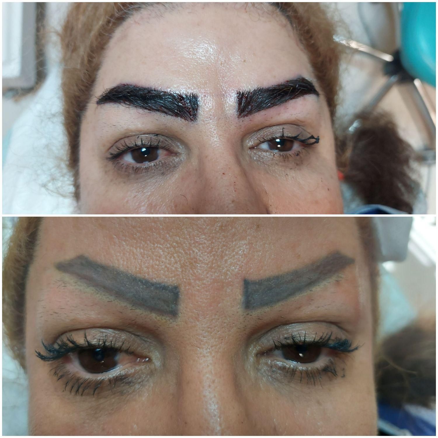 کلینیک مجوزدار کاشت ابرو در قم|خدمات آرایشگری و زیبایی|قم, ارم|دیوار