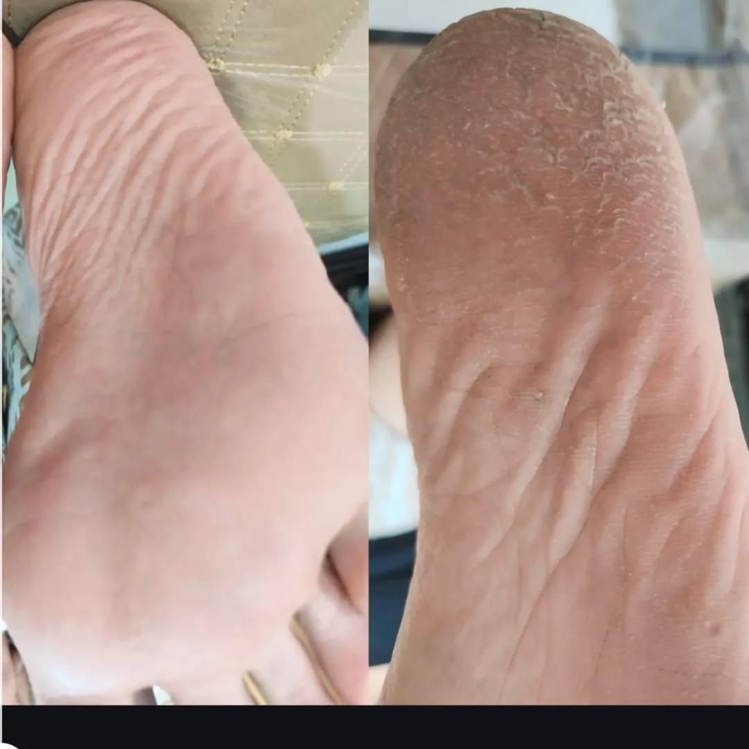 پدیکورتخصصی.وکف سابی و پارافین تراپی|خدمات آرایشگری و زیبایی|ارومیه, |دیوار