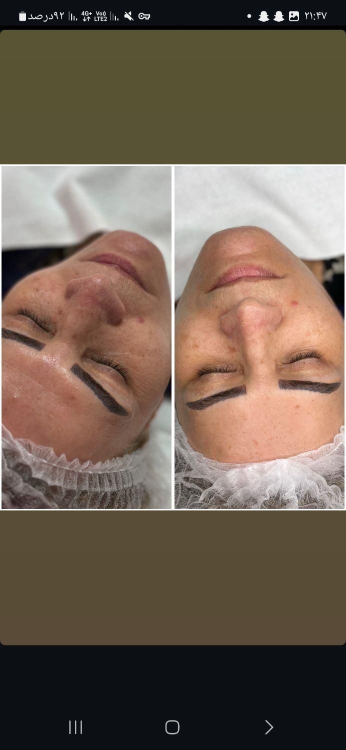 فیشال و پاکسازی کاشت مژه و لیفت ابرو|خدمات آرایشگری و زیبایی|رشت, جانبازان|دیوار